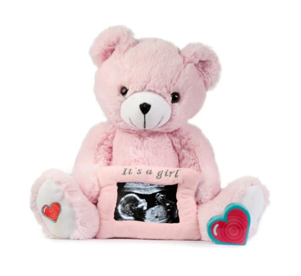 Bun in the Oven - Cutie Pie Scan - Fairbanks - Image 6