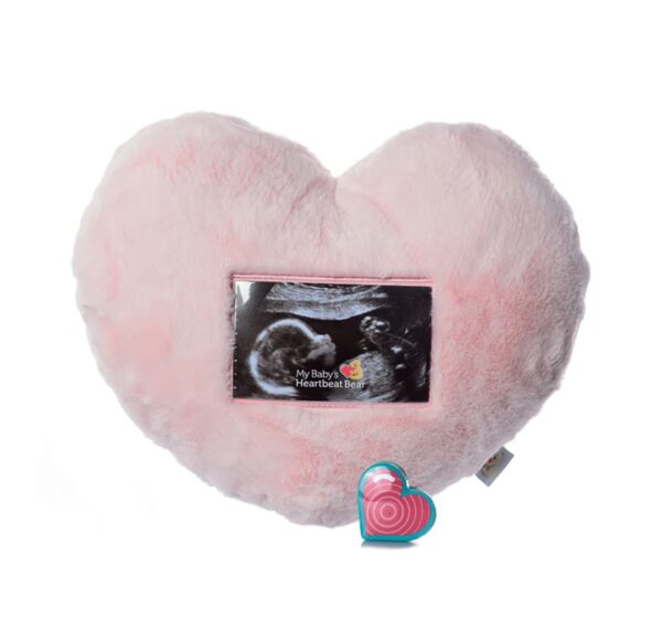 Bun in the Oven - Cutie Pie Scan - Fairbanks - Image 9