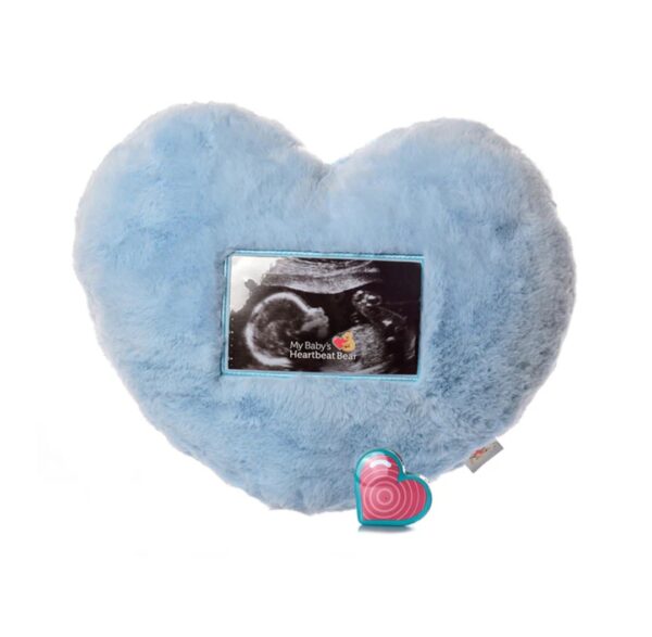 Bun in the Oven - Cutie Pie Scan - Fairbanks - Image 10